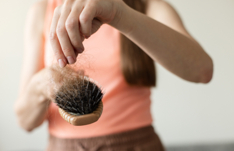 Person holding a hairbrush with visible hair shedding, a common concern during rapid weight loss or medication use.