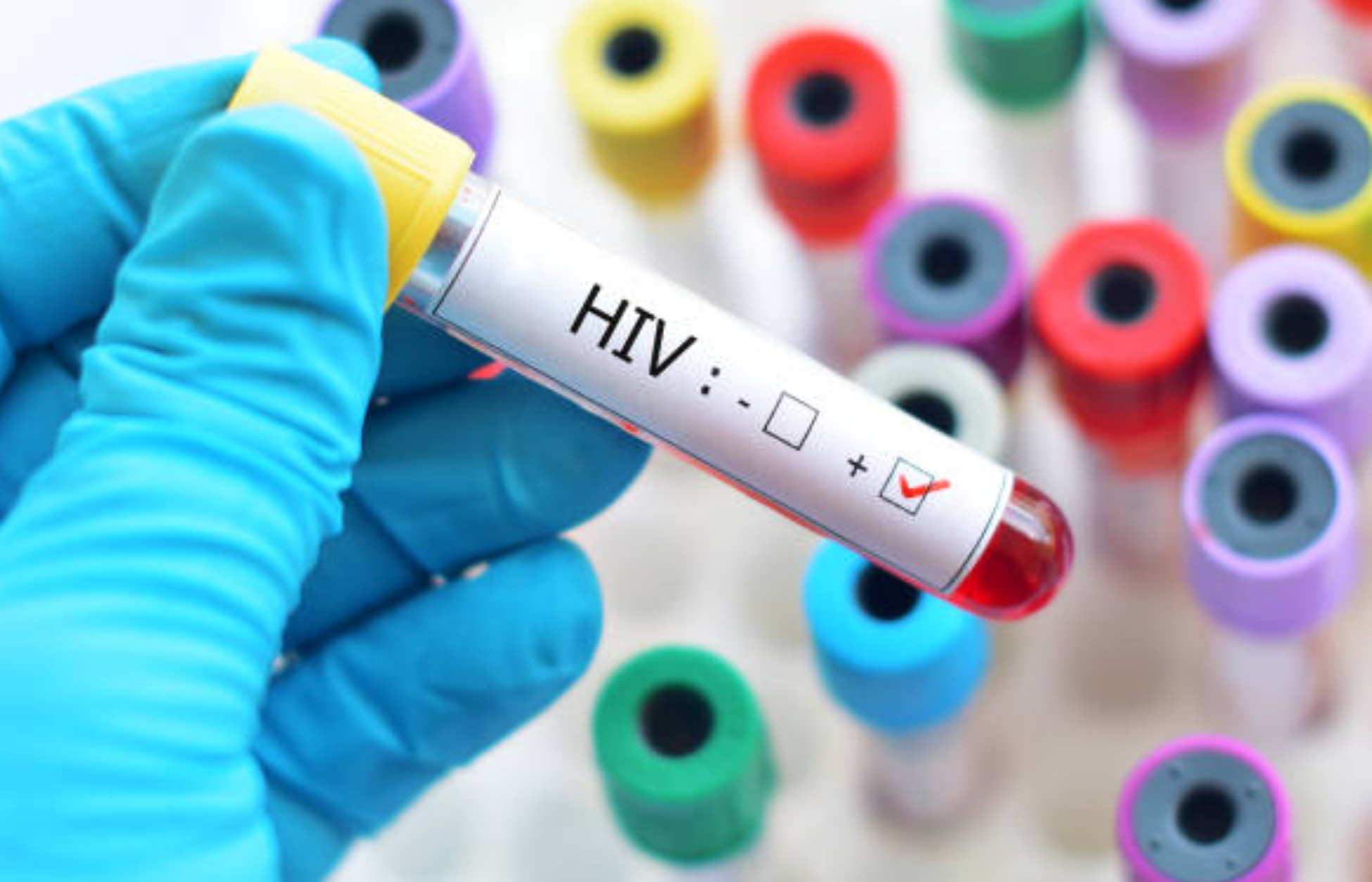 Gloved hand holding a blood sample tube labeled HIV positive.