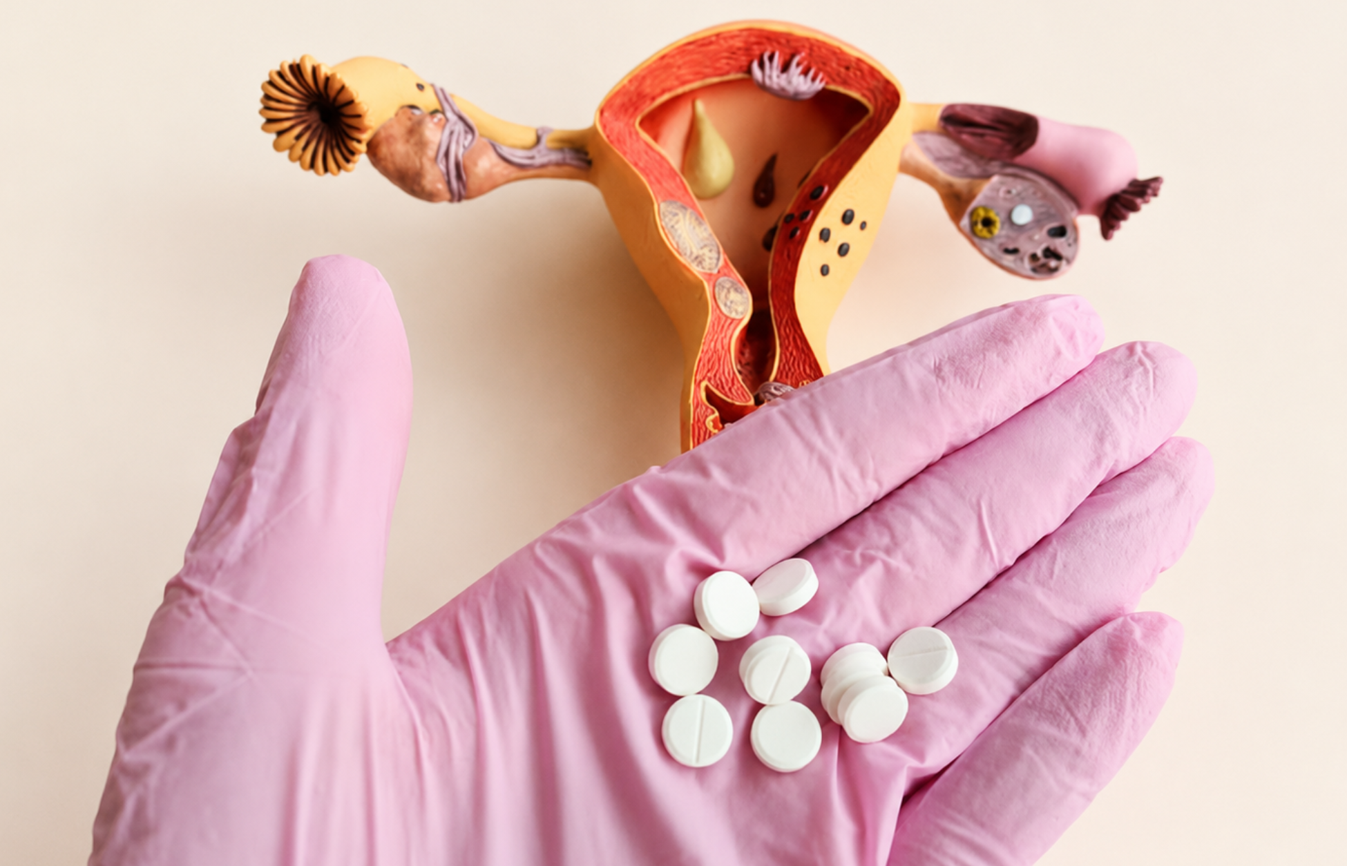 Pink-gloved hand holding white pills beside a female reproductive system model on a light background.