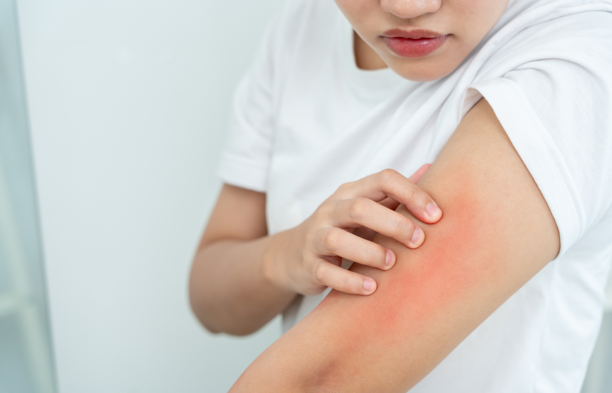 Person scratching a red, inflamed rash on the forearm, illustrating psoriasis-related skin irritation.
