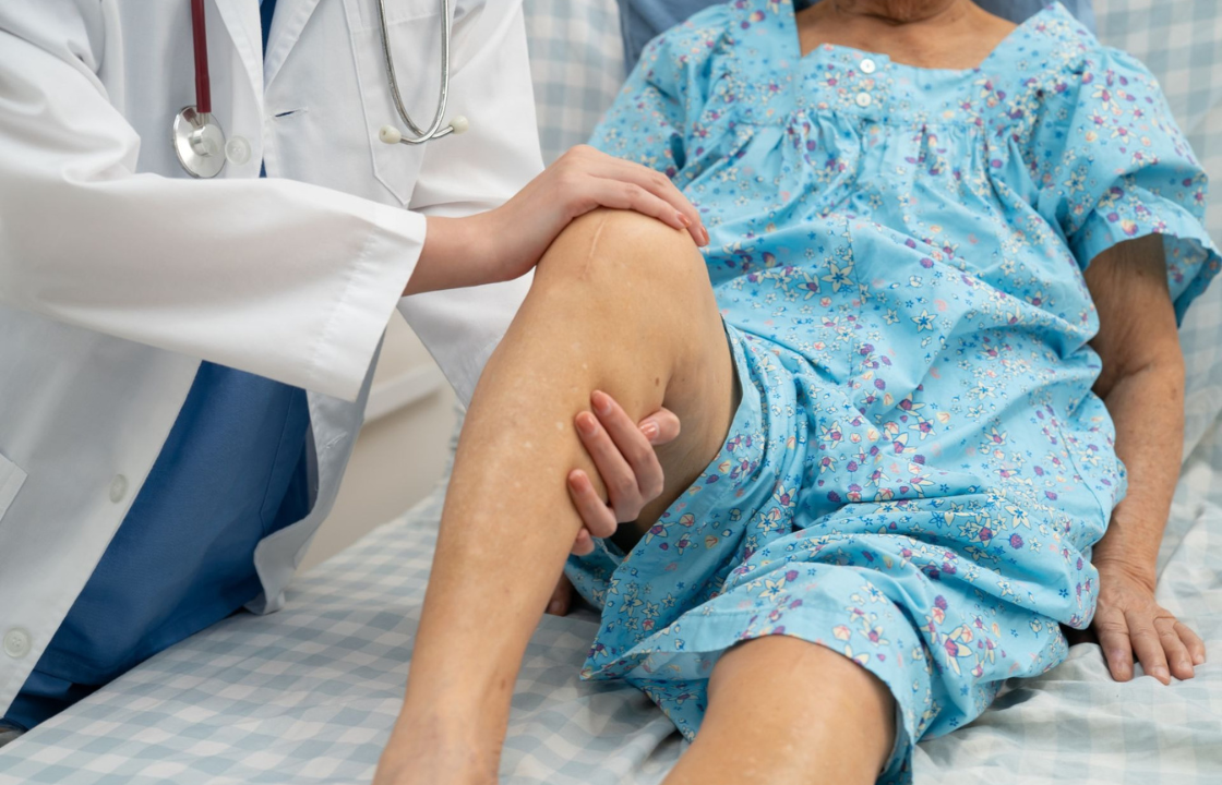Doctor examining an elderly patient's knee during a medical consultation, assessing joint health and mobility before potential treatment.