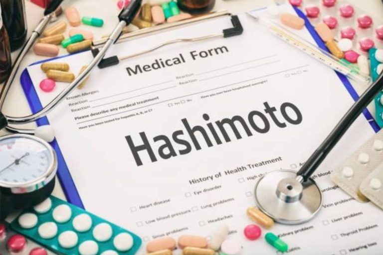 Medical form labeled "Hashimoto" surrounded by medications and diagnostic tools, representing Hashimoto’s disease management.