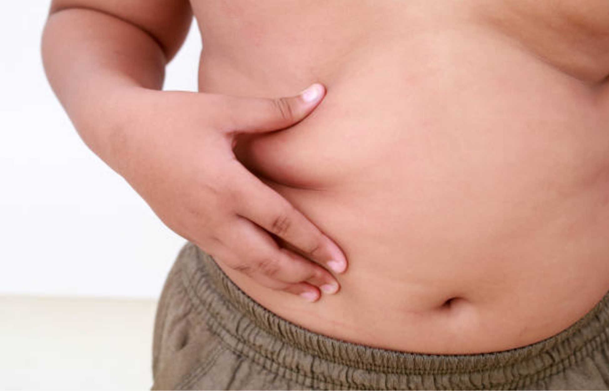 Close-up of a young child's abdomen with excess belly fat, illustrating childhood obesity.